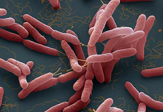 electronic microsocope photo of germs which are killed by bee propolis cream